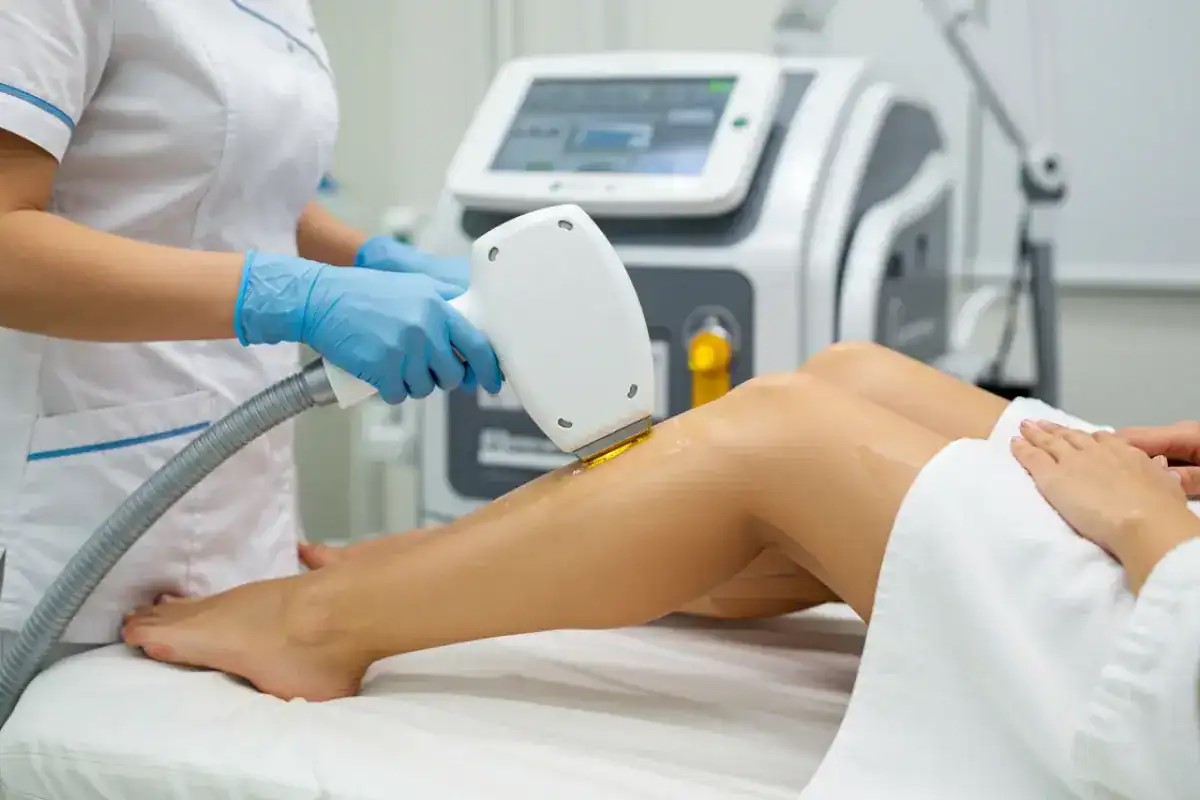 Se viene una super jornada de depilación láser: Ya tenés que sacar turno