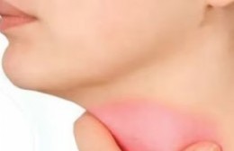 Alertan casos de faringitis por una bacteria